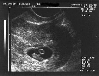 Эмбрион По Неделям Беременности Размеры Фото