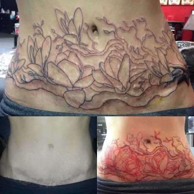 Как скрыть растяжки татуировкой на животе?
