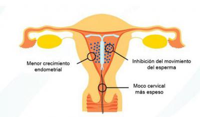 endometrium rák mirena)